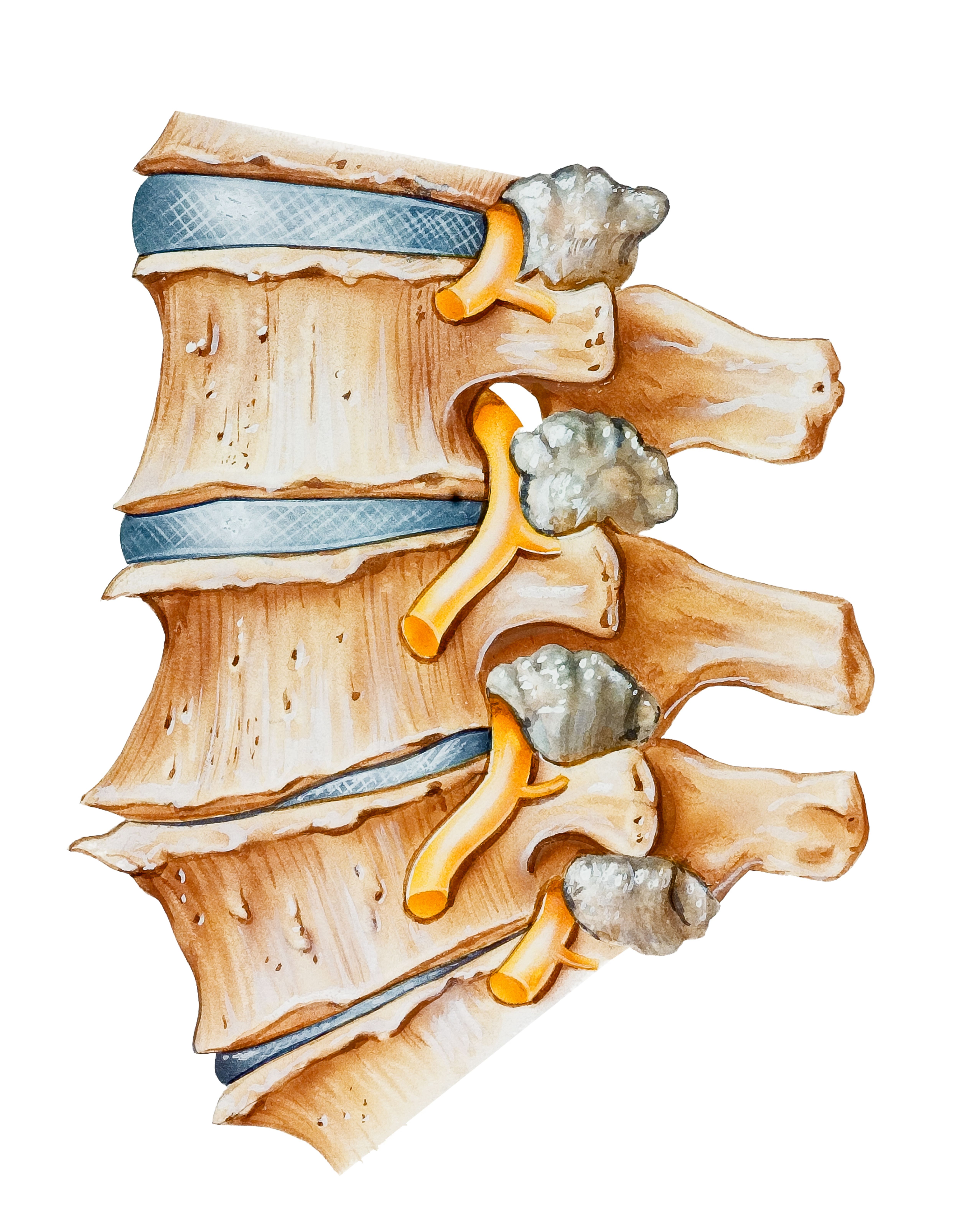 Comprendre l'arthrose