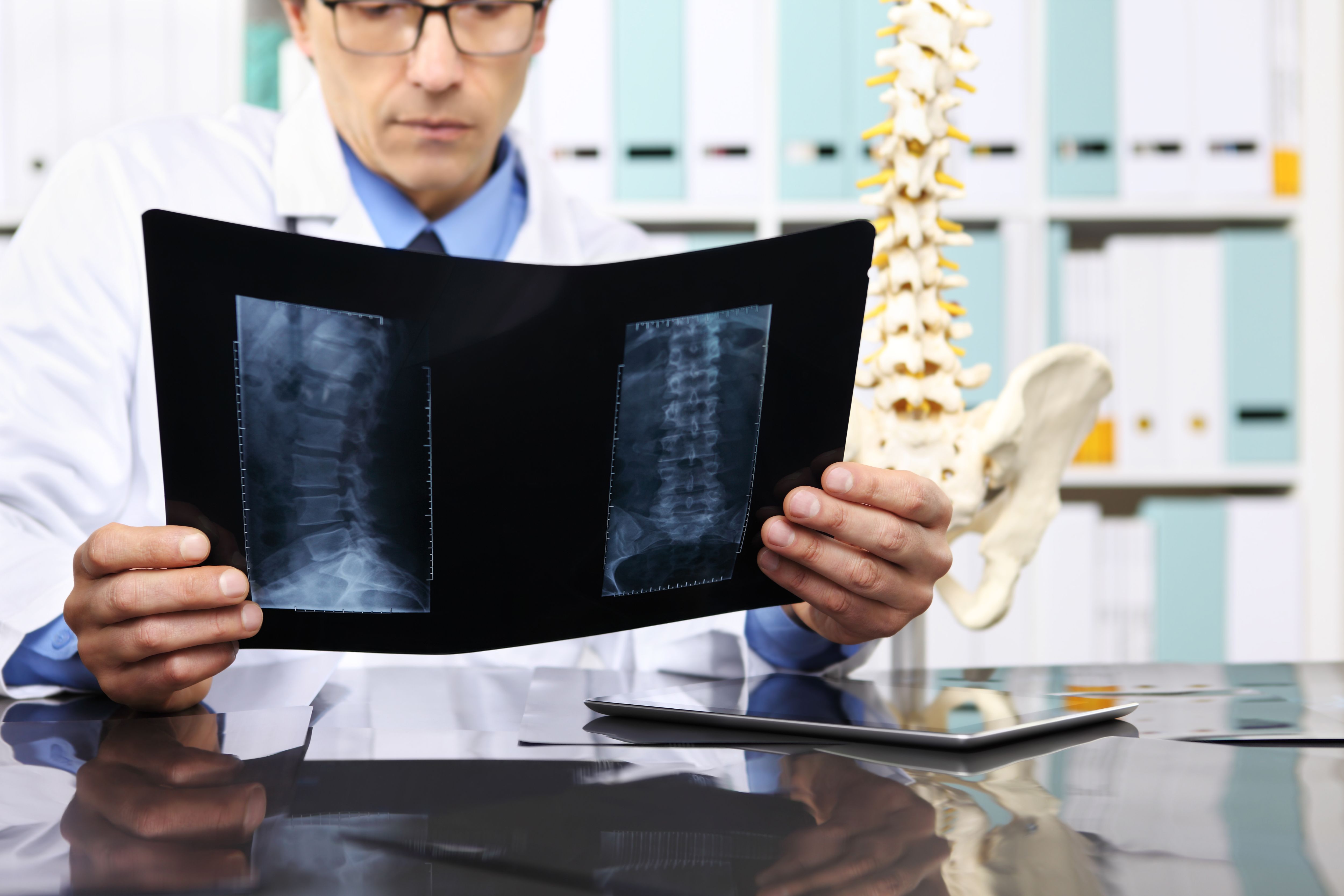 diagnostiquer la sciatique avec une radiographie