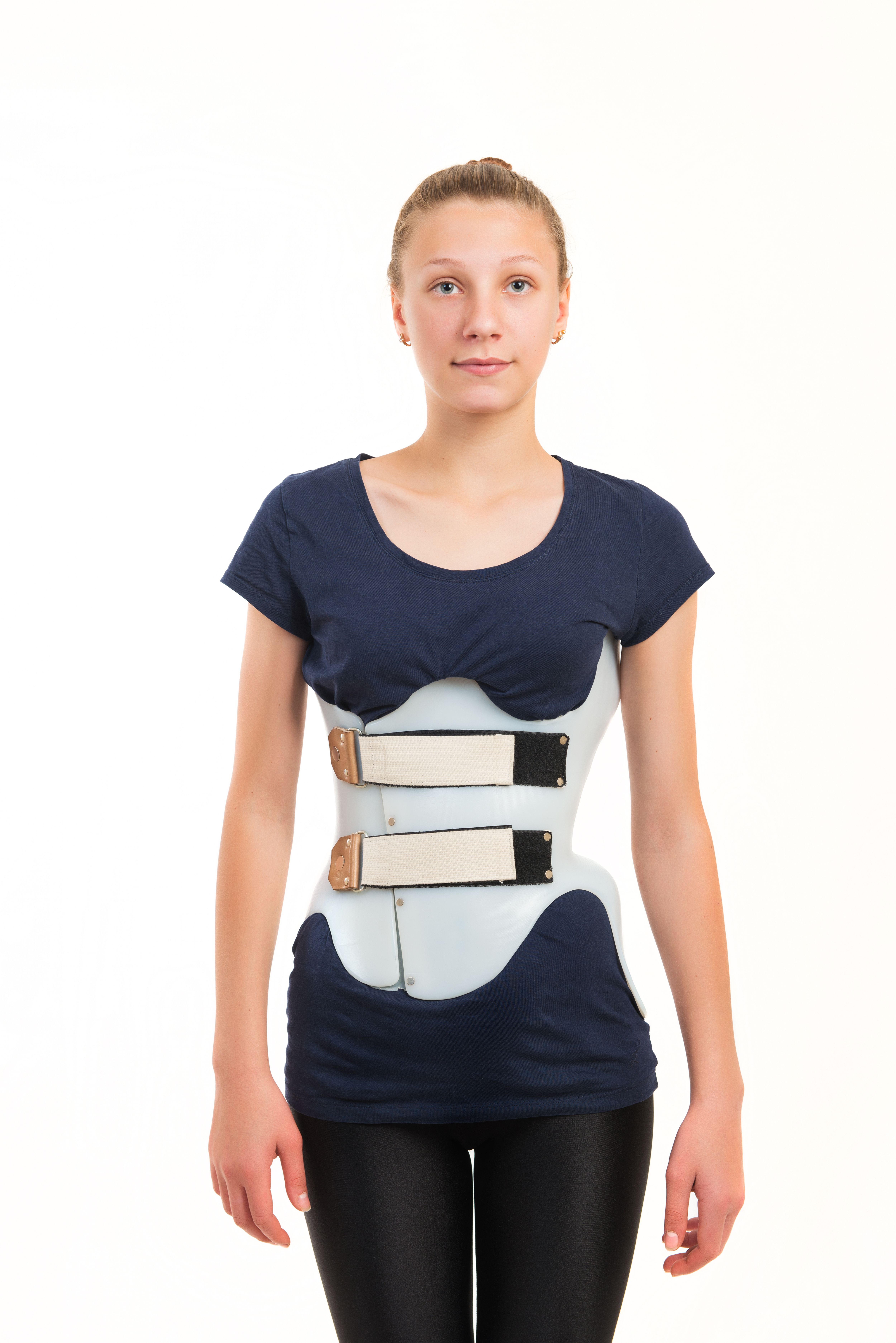 Traitement de la scoliose : le corset